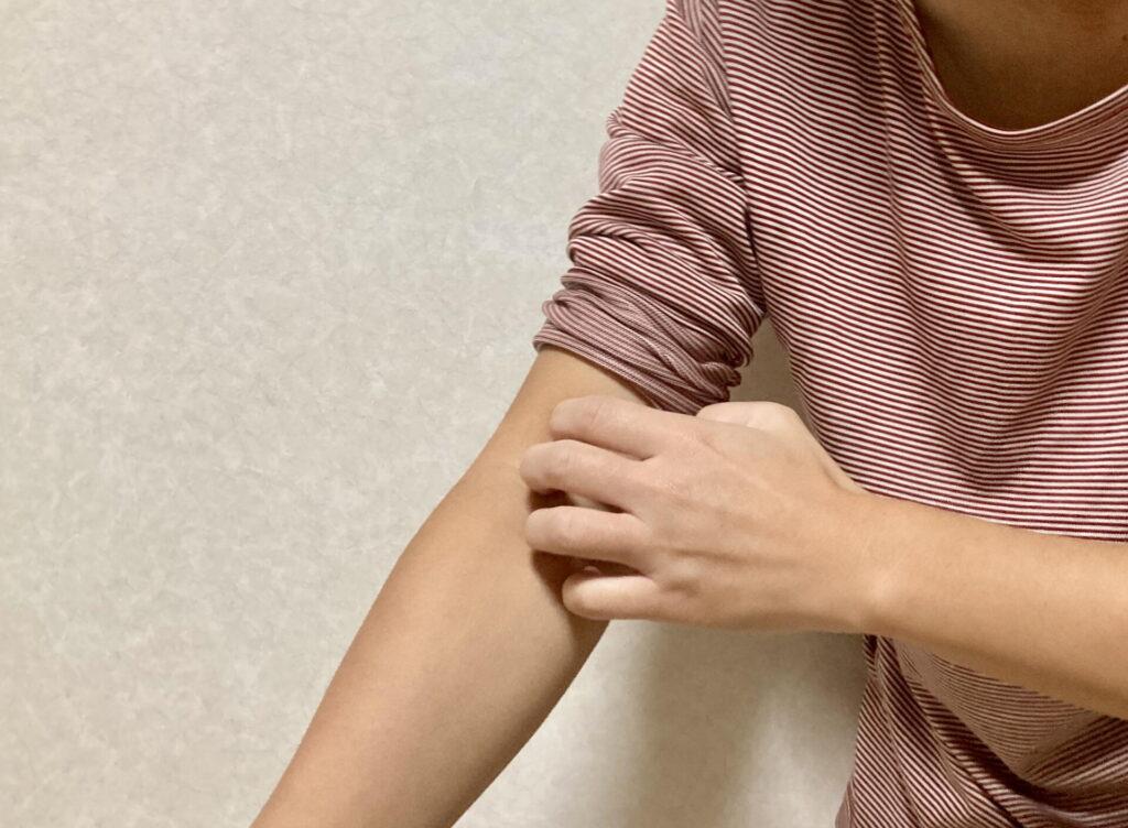 腕の内側を指でかいている人。トコジラミは寝ている間に腕や首など服から出た肌を刺す